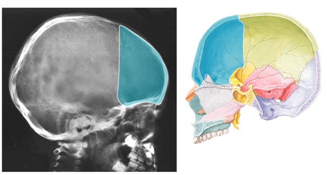 Radiology Comparison